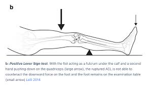 Image result for Fulcrum Test