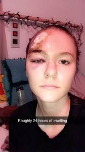 Asheville protestor likely hit by projectile from NC trooper