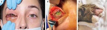She enjoys photography, gardening and running in her spare time. Woman At Risk Of Becoming Blind After Cowpox Infection From Pet Cat