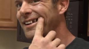 WATCH] 'DWTS': Noah Galloway's Tooth Kicked Out By Sharna Burgess — Video