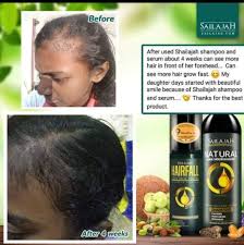 Hair serums can benefit just about any hair type, and the awesome thing about serums is that they offer your hair a lovely shine, reduce frizziness, smooth your hair and smell amazing. Sailajah Hair Serum And Syampoo Shopee Malaysia