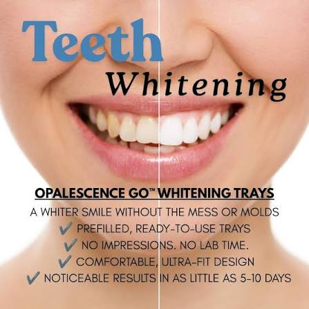 This spring we are highlighting our whitening options to help you get ready for all your big events coming up this summer! We will be offering a special promotion on our take