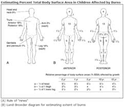 lund and browder chart wikipedia