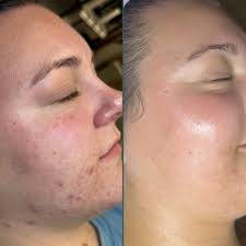 Wittney Fratt Snyder