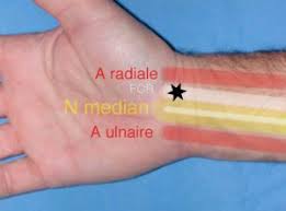 Mais c'est aussi une condition sine qua non à notre survie. Infiltration Du Canal Carpien Chirurgie De La Main De L Epaule Et Du Membre Superieur