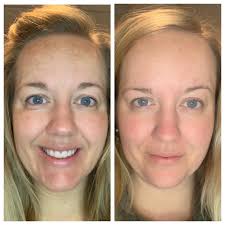 When will Lumi cream be available?