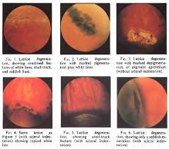 Pin On Eye Doctor