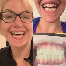 I did say I would give some updates