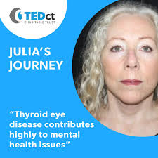 TEDct: Thyroid Eye Disease Charitable Trust