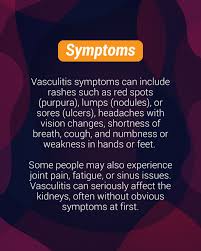 Image result for Vasculitis