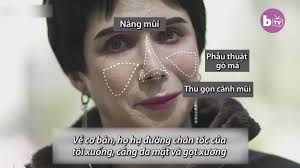 Chàng trai Anh phẫu thuật thành thần tượng BTS