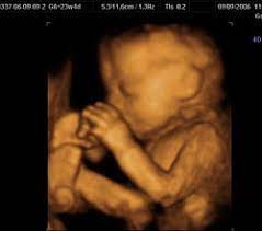 Heartbeat check $30 (starting at 7 weeks). 3d Ultrasound Images In New York Ny Manhattan