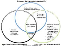 Image result for Right Heart Failure