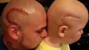 This Dad Got A Tattoo Of His Son's Cancer Surgery Scar To Help Him Feel  Less Self-Conscious