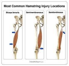 Healing solutions for hamstring injuries. 3cb Performance The Three Do S And Don T For Runners After Hamstring Injury