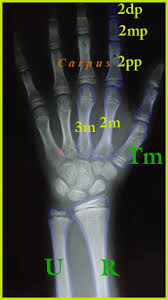 Image result for Growth Plate