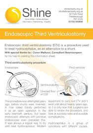 Pin On Hydrocephalus Shine