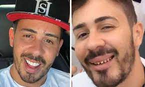 O maior fã clube do mc kevinho!! Kevinho Compartilha Fotos Dos Dentes Sem Lentes E Diverte Internautas