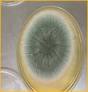 Resultado de imagen de Aspergillus
