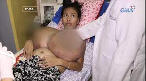Filipina with real macromastia (gigantic growing boobs) | xHamster