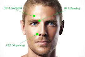 acupuncture restores facial movements for stroke patients