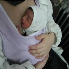 Kangaroo Mother Care Technique | Download Scientific Diagram