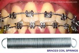 Jul 14, 2021 · there are many ways to get straight teeth without traditional metal braces. Broken Braces Coil Spring How To Fix Why This Happens Orthodontic Braces Care
