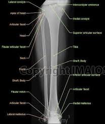 Image Result For Anatomy Musculoskeletal X Ray Radiography Student Radiography X Ray