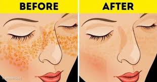 Pin On Beauty Hacks