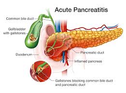 Image result for pancreas)