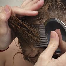 Hair bleach contains chemicals, together with ammonia persulfate, an oxidizing agent that removes the color from hair. Does Hair Dye Kill Lice The Whole Truth Here