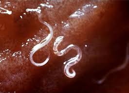 Sora mea a fost diagnosticata cu stafilococ auriu in gat. Stafilococul Auriu Archives Tratament Naturisttratament Naturist