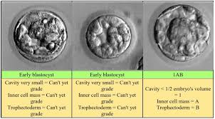 From Egg To Embryo Pcos To Mommy