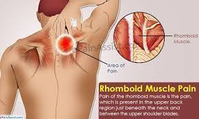 Pin On Pain