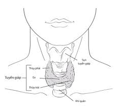 Ung thư tuyến giáp có thể gồm nhiều loại khác theo thống kê, hầu hết trường hợp ung thư ở tuyến giáp đều có tiên lượng tốt và tỷ lệ sống cao, đặc biệt nếu người bệnh phát hiện vấn đề ngay từ. Nguyen Nhan Hinh Thanh Ung ThÆ° Tuyáº¿n Giap Vnexpress Sá»©c Khá»e