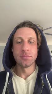 48-Hour Skin Update After RF Microneedling Treatment