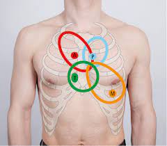 It is performed before percussion or palpation as vigorously touching the abdomen may disturb the intestines, perhaps artificially altering their activity and thus bowel sounds. Heart Auscultation Signs And Symptoms Mcmaster Textbook Of Internal Medicine