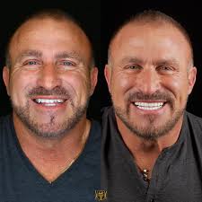 Frank Catania (@frank.catania.sr) • Instagram photos and videos