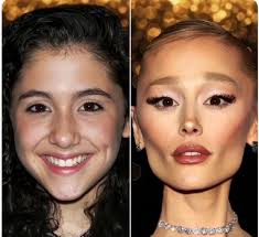 What is it about fame that does this to people?