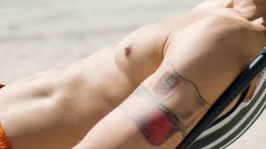 The preva­lence of tat­toos in aus­tralia has shown an increase to 15 per­cent in 2004 through 2005 from the 10 per­cent in 1998. Does Laser Tattoo Removal Increase Skin Cancer Risk Collins Cosmetic Clinic
