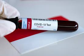 Masuk Tahap Validasi Unpad Itb Kembangkan Rapid Test Antigen Covid 19