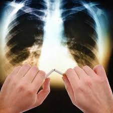 بالصور كيف تقي نفسك من سرطان الرئة ويب طب