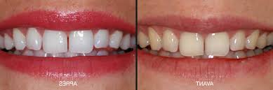 Blanchir Dent Aroma Zone Expert 2020