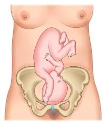 Image result for Compound Presentation