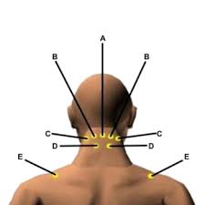 A diagram showing nerves in the head and neck. Massages For Muscle Knots In The Neck The Massage Rooms