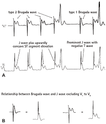 Image result for J Wave