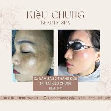 Kiều Chung Beauty Spa