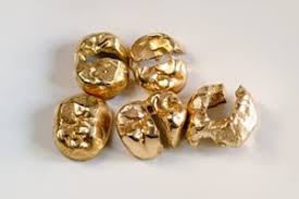 We did not find results for: Sell Dental Gold Scrap Precious Metals Refinery