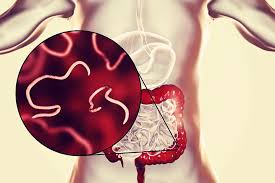 Image result for Pinworm