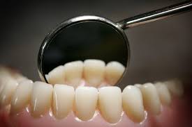 How much time does a dental cleaning take. Dental Hygiene Did People In The Middle Ages Have Bad Teeth